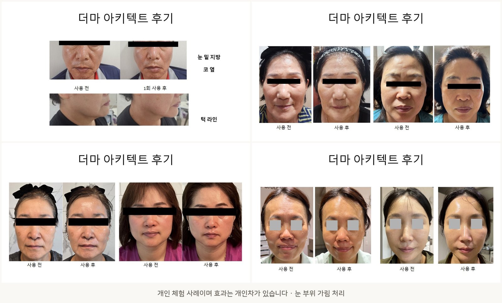 더마아키텍트 체험 전후 사진 모음